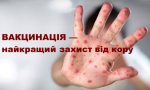Кір: небезпечна інфекція, яку можна попередити вакцинацією